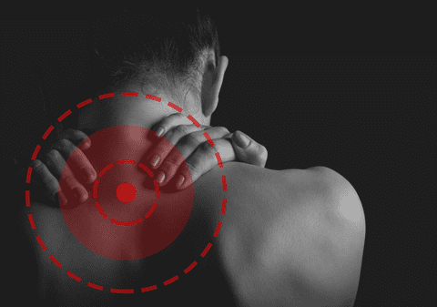 Cum scapi de gâtul înţepenit. Torticolis: cauze, simptome și diagnosticare