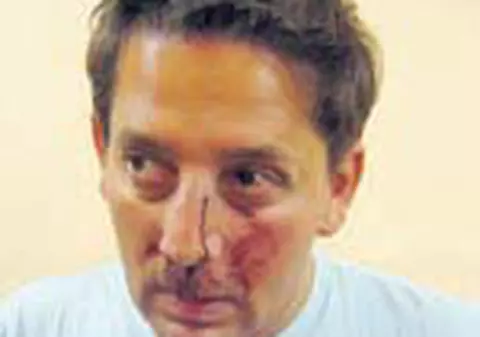 Costin Marculescu, atacat in scara blocului