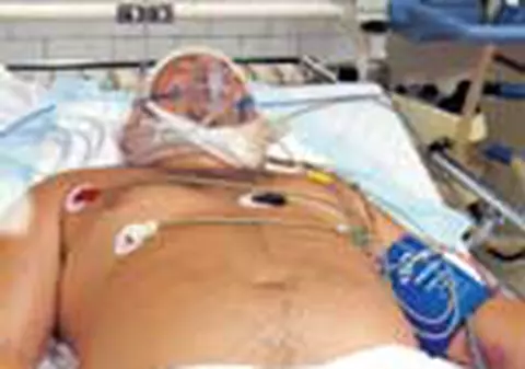 'A tintit si a tras'