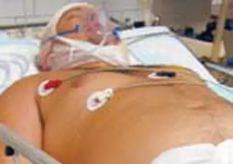 Costin a facut septicemie