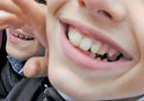 Copiii merg gratuit la dentist