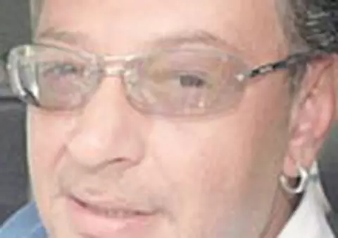 Bodo, operat la ochi cu laser