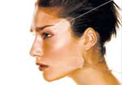 'Am 24 de  ani si mi-au aparut deja riduri. Cum scap de ele?'