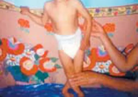 Andrei are nevoie de o orteza