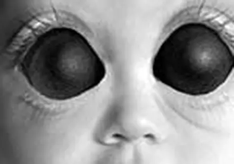 Copilul cu ochi de musca