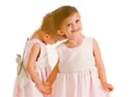 Siamezele au fost externate