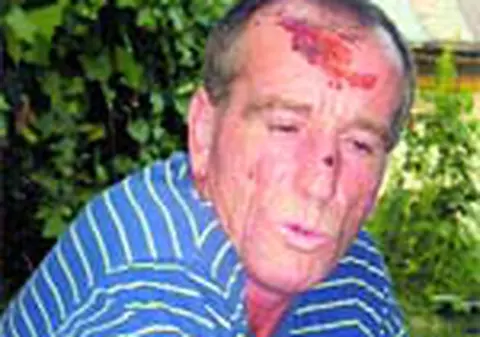 A furat 50 &euro; de la un mort ca sa supravietuiasca