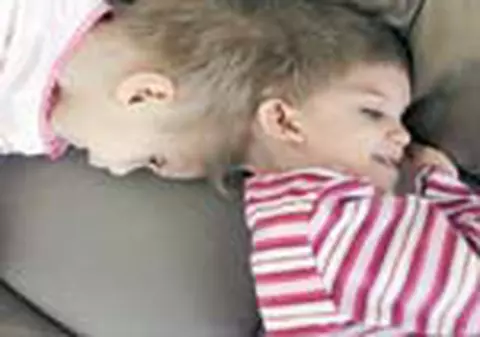 Siamezele romance ar putea fi separate in 2008