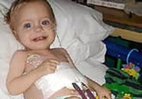 Un bebelus traieste cu o inima artificiala