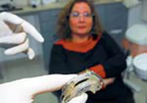 Care e diferenta dintre proteza scheletata si cea clasica