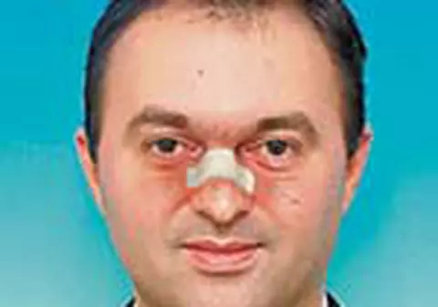 Adomnitei isi 'scoate' nasul astazi din spital