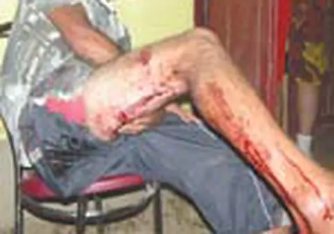 Victimele bataii de la Obarsia de Camp sunt inca in spital