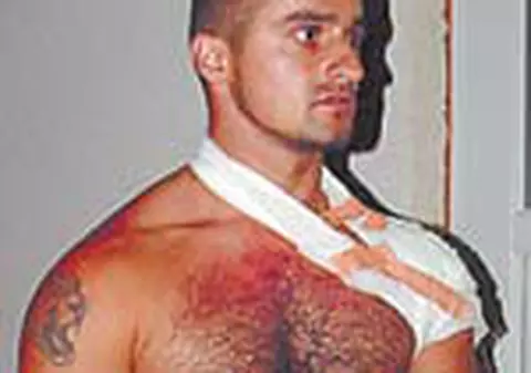 A impuscat un barbat si a calcat cu masina o fata