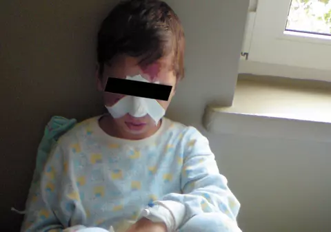 Copil bătut şi ars cu ţigara de mama lui 