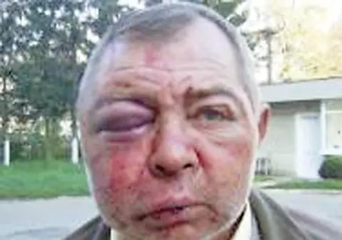 Fratele unui consilier, bătut de un nebun