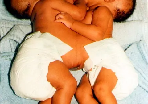 Va fi cea mai tânără mamă de siamezi din Marea Britanie