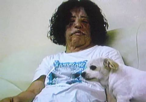 Şi-a injectat  în faţă ulei de gătit!