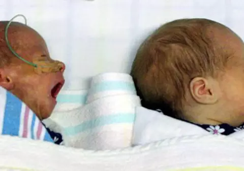 O româncă aşteaptă să nască tripleţi în Spania