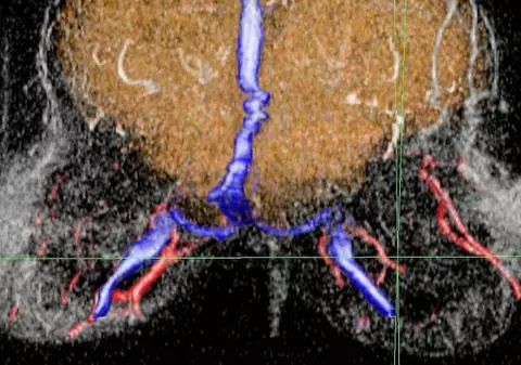 Visele şi gândurile vor putea fi transpuse pe computer