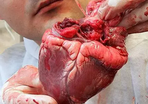 I-a crescut inima la loc