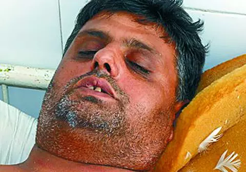 Şoferul care a călcat cu BMW-ul său doi turişti care făceau plajă, urmărit penal