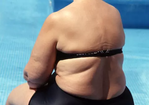 Au trimis-o la Zoo pentru un RMN!