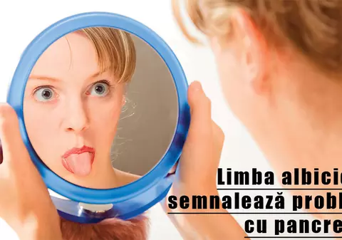 Limba îţi spune ce boli ai