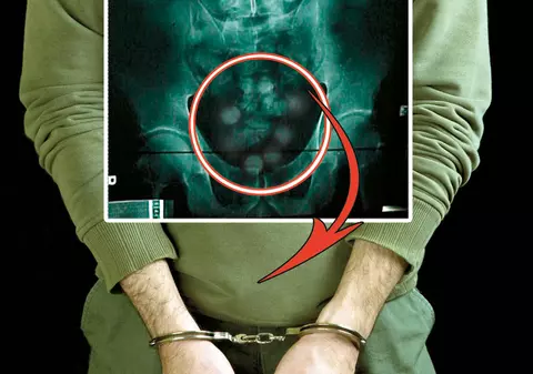 Aşa arată cocaina în burta unui cărăuş