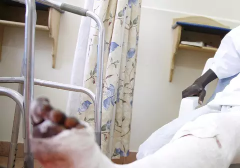 Şi-a rupt piciorul ca să-şi pună un ghips din cocaină