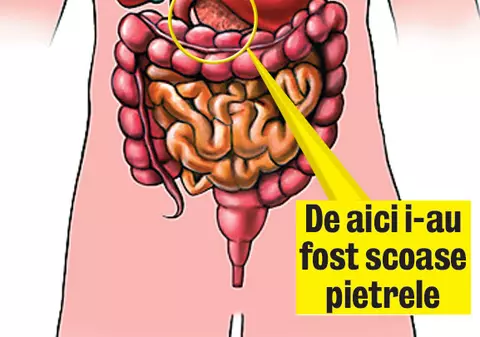 Ilie Sârbu, din nou la cuţit