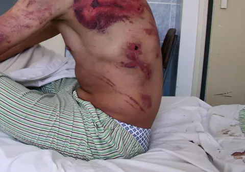 Familia unui tânăr moldovean susţine că acesta a fost omorât de poliţie