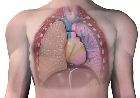 Au găsit un arbore de cinci centimetri în plămânul unui bărbat