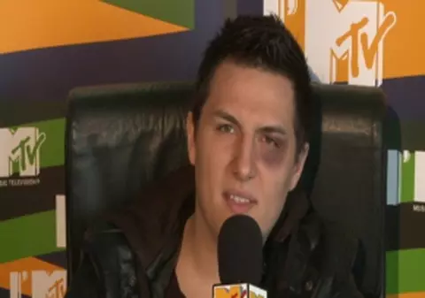VIDEO / Gabi Huiban prezintă MTV “Euro Top 20” cu un ochi vânăt!