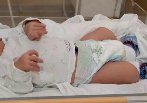A făcut stop cardiac după ce a născut un băieţel de 6 kg