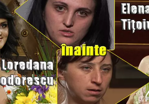 "Frumuseţe pe muchie de cuţit" a rezolvat complexele din copilărie a două femei