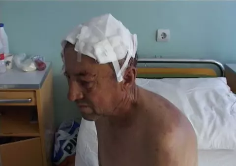 O bătrână de 70 de ani a bătut hoţul cu sapa