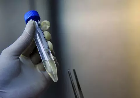 Gripa porcină ia amploare: 53 de cazuri în România