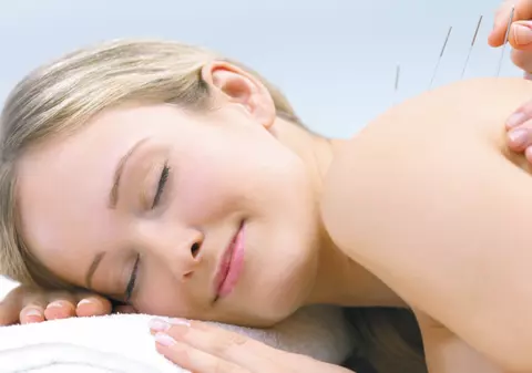 Acupunctura vindecă insomnia