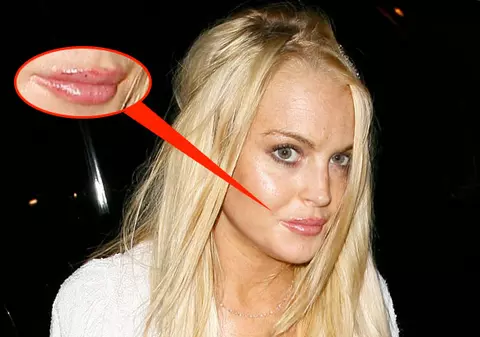 Lindsay ce ţi-ai făcut la buze?