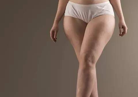 Obezitatea se transmite de la mamă la fiică şi de la tată la fiu