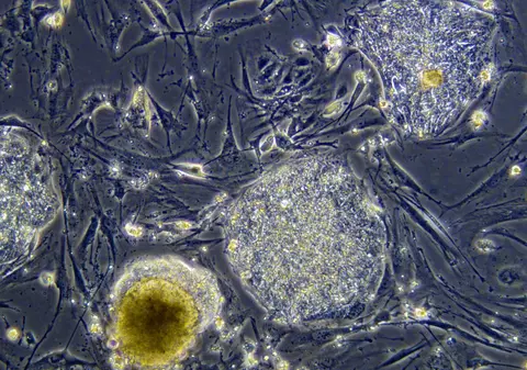 Vaccinul împotriva gripei porcine este cancerigen?