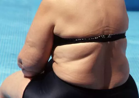 A murit înainte de nuntă, pentru că a slăbit 19 kilograme
