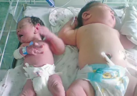 Mama bebeluşului gigant abia aşteaptă să-şi ţină fetiţa în braţe