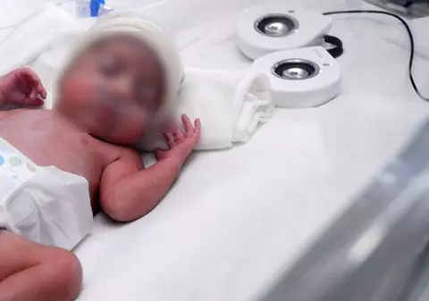 Bebeluşul ars în incubator va fi supus unui transplant de piele