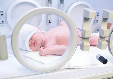 Bebeluşului ars în incubator i s-a făcut transplant de piele