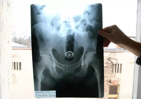 A stat trei zile cu tubul unui spray în anus