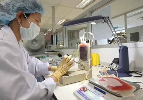 Virusul HIV este distrus de celulele stem