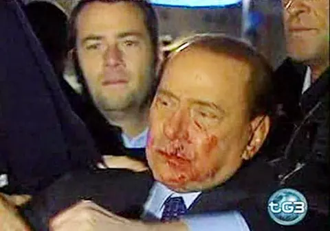 Berlusconi, obligat să mai rămână în spital