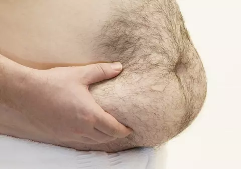 Bătrânii obezi trăiesc mai mult decât cei slabi