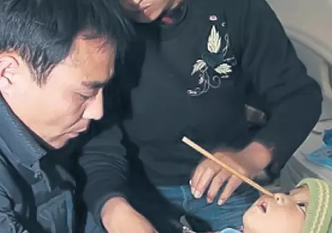 La un pas de moarte după ce i s-a înfipt un băţ în creier